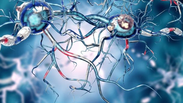 Trasplantes cerebrales con células madre son seguros en pacientes con párkinson, según ensayos clínicos Trasplantes cerebrales con células madre son seguros en pacientes con párkinson, según ensayos clínicos