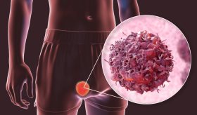 Jóvenes entre 15 y 35 años, los más vulnerables al cáncer testicular en Puerto Rico