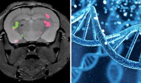 RM multicolor facilitaría el seguimiento de terapias celulares en cáncer, Alzheimer y otras enfermedades