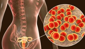 Investigadores desarrollan gepotidacina tratamiento oral contra la gonorrea resistente