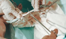 Cambios en ADN de la sangre de cordón umbilical podría detectar riesgos tempranos de problemas de salud