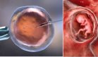 Nueva técnica genómica podría evitar abortos espontáneos en tratamientos de fertilidad