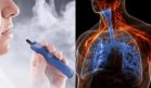 Confirman bronquiolitis obliterante en joven de 17 años por uso prolongado de cigarrillos electrónicos