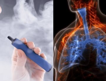 Confirman bronquiolitis obliterante en joven de 17 años por uso prolongado de cigarrillos electrónicos