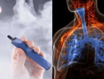 Confirman bronquiolitis obliterante en joven de 17 años por uso prolongado de cigarrillos electrónicos