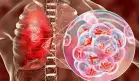 Fármaco navitoclax contra el cáncer podría mejorar el tratamiento de la tuberculosis, según estudio