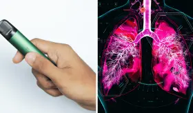 Uso de cigarrillos electrónicos incrementa en un 129 % el riesgo de EPOC según estudio