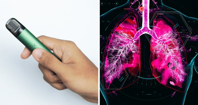 Uso de cigarrillos electrónicos incrementa en un 129 % el riesgo de EPOC según estudio
