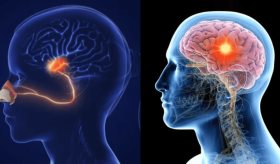 La pérdida de olfato podría anunciar enfermedades neurodegenerativas años antes del diagnóstico 