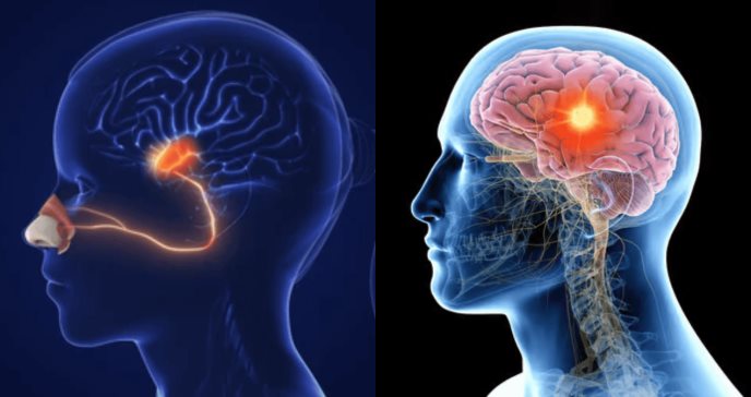 La pérdida de olfato podría anunciar enfermedades neurodegenerativas años antes del diagnóstico 