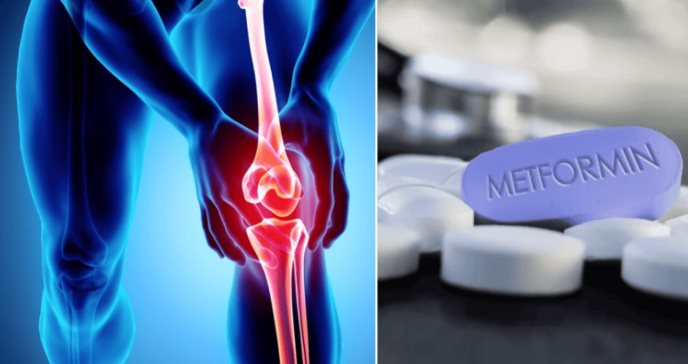 Medicamento Metformina para la diabetes demostró eficacia para la osteoartritis y el dolor de rodilla