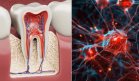 Células madre dentales podrían regenerar el cerebro: Avance contra Huntington, párkinson y la epilepsia