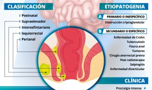 ABSCESOS PERIANALES