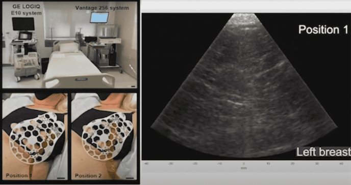 Así funciona el sostén con ultrasonido para detectar cáncer de mama en segundos
