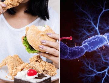 Alimentos ultraprocesados aumentarían el riesgo de síntomas asociados al párkinson, según estudio