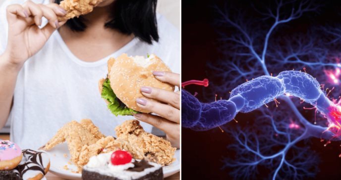 Alimentos ultraprocesados aumentarían el riesgo de síntomas asociados al párkinson, según estudio