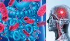 Descubren que el consumo de probióticos podría prevenir el alzhéimer y el deterioro cognitivo
