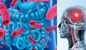 Descubren que el consumo de probióticos podría prevenir el alzhéimer y el deterioro cognitivo