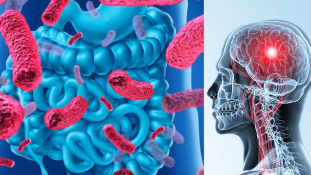 Descubren que el consumo de probióticos podría prevenir el alzhéimer y el deterioro cognitivo Descubren que el consumo de probióticos podría prevenir el alzhéimer y el deterioro cognitivo