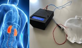 Crean mascarilla que podría detectar la enfermedad renal crónica a través del aliento
