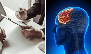 Cambios estructurales en el cerebro se asocian con jornadas laborales superiores a 52 horas semanales