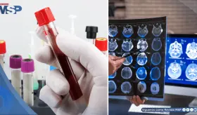 La FDA aprueba el primer análisis de sangre que identifica biomarcadores tempranos del alzhéimer  