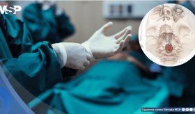 Realizan histórica cirugía a través del ojo para la extirpación de cáncer de médula espinal