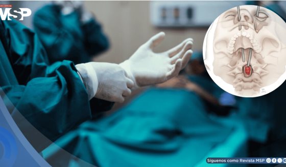 Realizan histórica cirugía a través del ojo para la extirpación de cáncer de médula espinal