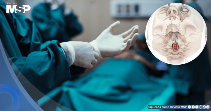 Realizan histórica cirugía a través del ojo para la extirpación de cáncer de médula espinal