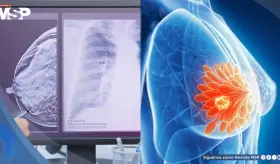 Mujeres jóvenes con alto riesgo de cáncer de mama no reconocen síntomas clave, según estudio