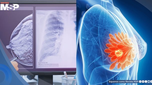 Mujeres jóvenes con alto riesgo de cáncer de mama no reconocen síntomas clave, según estudio Mujeres jóvenes con alto riesgo de cáncer de mama no reconocen síntomas clave, según estudio
