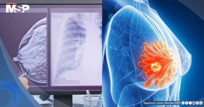 Mujeres jóvenes con alto riesgo de cáncer de mama no reconocen síntomas clave, según estudio