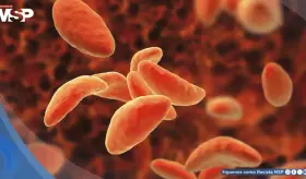 Desarrollan folleto educativo de toxoplasmosis transmitido por carne cruda, y heces de gato: Estudio