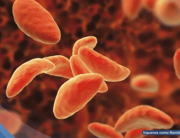 Desarrollan folleto educativo de toxoplasmosis transmitido por carne cruda, y heces de gato: Estudio
