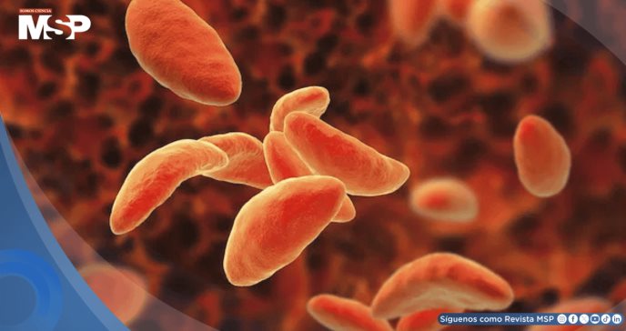 Desarrollan folleto educativo de toxoplasmosis transmitido por carne cruda, y heces de gato: Estudio