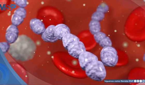 La sepsis es la tercera causa de muerte en adultos en Puerto Rico: Retrasos en el diagnóstico