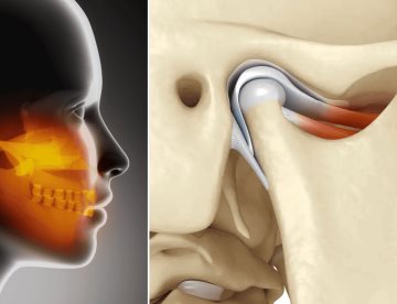 ¿Dolor en mandíbula, oído o cabeza? Podría deberse a la articulación temporomandibular y no a migrañas