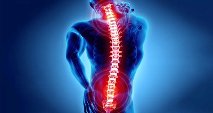 Nuevos criterios para espondiloartritis axial con especificidad del 90 % y mejor sensibilidad