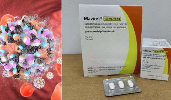 FDA aprueba expansión de MAVYRET® para tratar la hepatitis C aguda en adultos y niños desde los tres años
