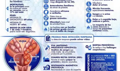 C&Aacute;NCER DE PR&Oacute;STATA: PREVENCI&Oacute;N Y DETECCI&Oacute;N TEMPRANA