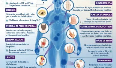 ESTIGMAS HEP&Aacute;TICOS