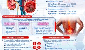 CÁNCER DE RIÑÓN: TUMOR MALIGNO DEL SISTEMA URINARIO