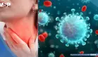 Identifican nueva variante de COVID-19 apodada garganta de cuchilla por su síntoma característico