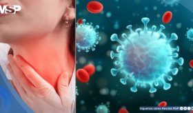 Identifican nueva variante de COVID-19 apodada garganta de cuchilla por su síntoma característico