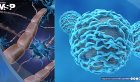 Inmunoterapia deja exclusividad en cáncer: avanza en alzhéimer, esclerosis múltiple y otras patologías