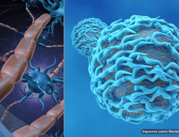 Inmunoterapia deja exclusividad en cáncer: avanza en alzhéimer, esclerosis múltiple y otras patologías