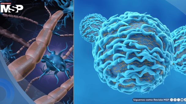 Inmunoterapia deja exclusividad en cáncer: avanza en alzhéimer, esclerosis múltiple y otras patologías Inmunoterapia deja exclusividad en cáncer: avanza en alzhéimer, esclerosis múltiple y otras patologías