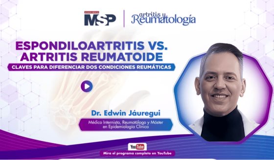 Espondiloartritis vs. Artritis reumatoide