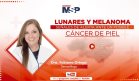 Lunares y melanoma: Señales de alerta ante un posible cáncer de piel