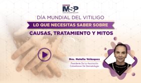 Día mundial del vitiligo: Lo que necesitas saber sobre causas, tratamiento y mitos
